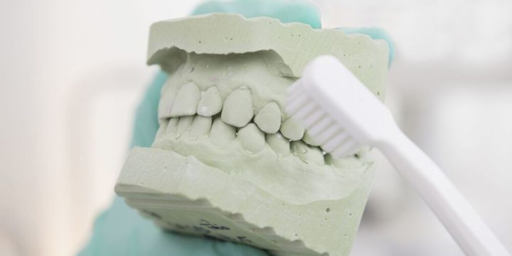 5 неожиданных вещей, портящих твои зубы
