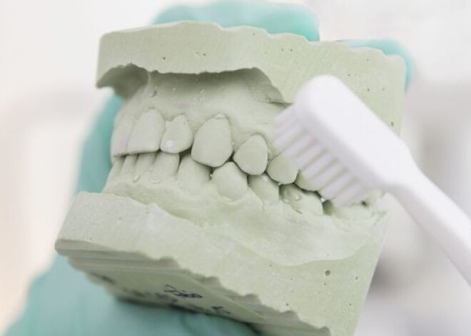 5 неожиданных вещей, портящих твои зубы