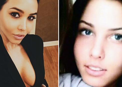 Решетова пластики фото - 86 фото