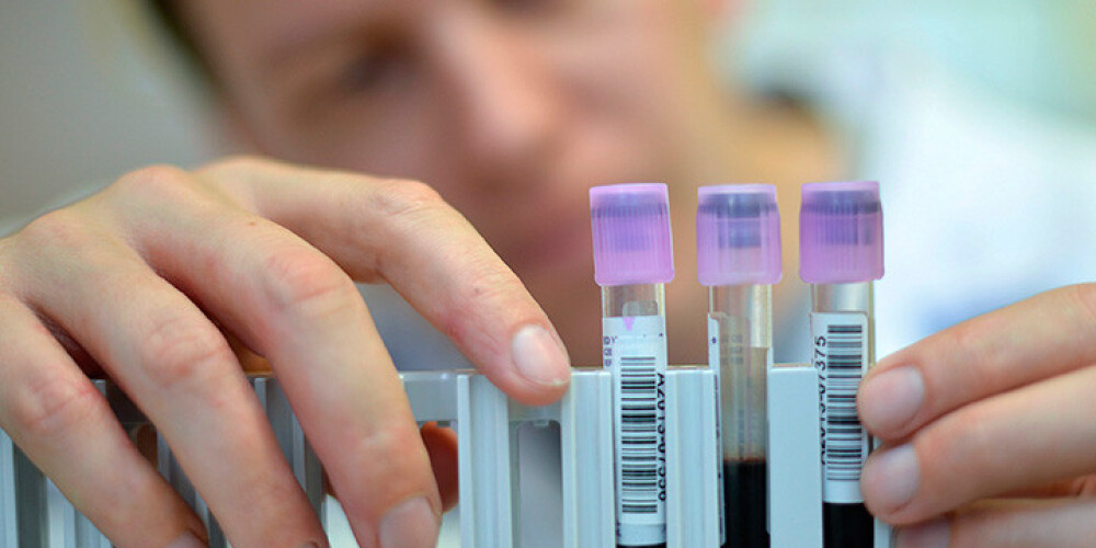 Apturēta vienīgā akreditētā dopinga laboratorija Āfrikas kontinentā