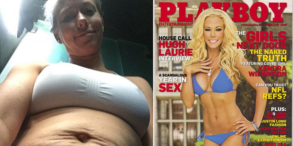 Экс-модель Playboy не стесняется растяжек на животе после двух беременностей