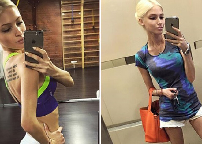 Алена Шишкова снова шокировала анорексичным видом. ФОТО