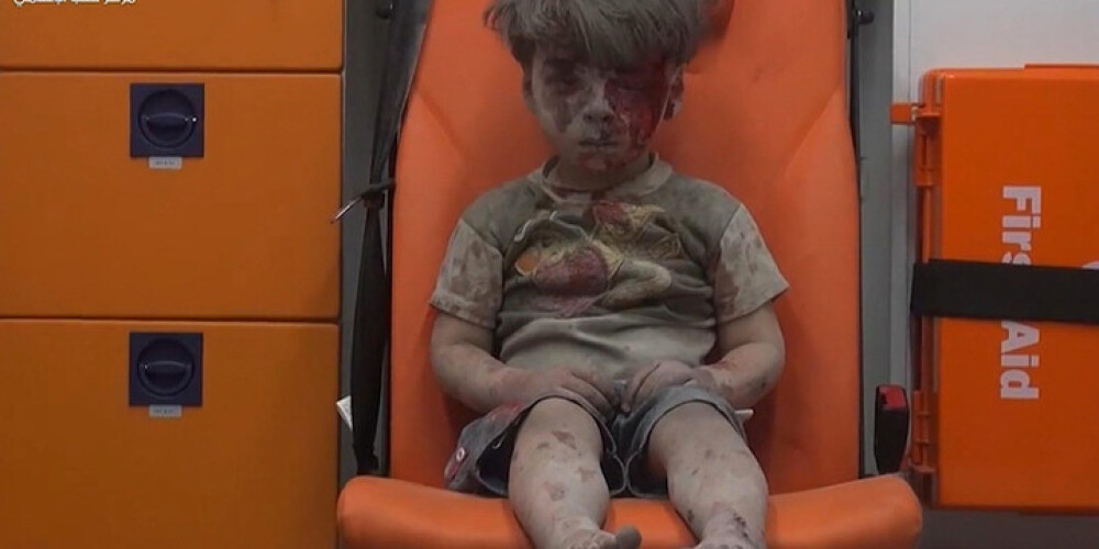 Pēc gaisa triecieniem Alepo nofotografētā puisīša brālis miris no gūtajām traumām