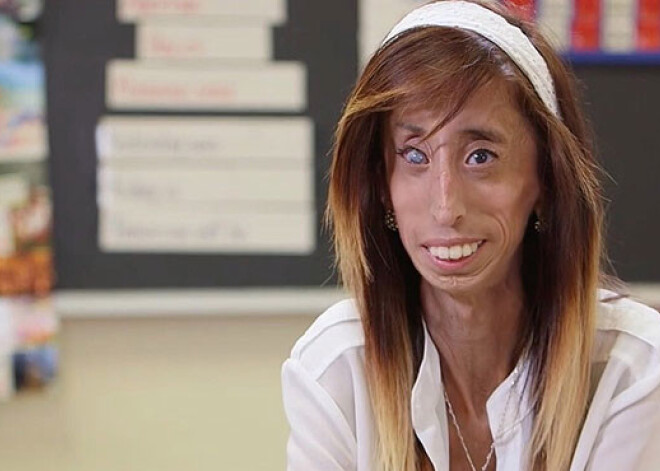 Самая «уродливая женщина в мире» рассказала о своей жизни