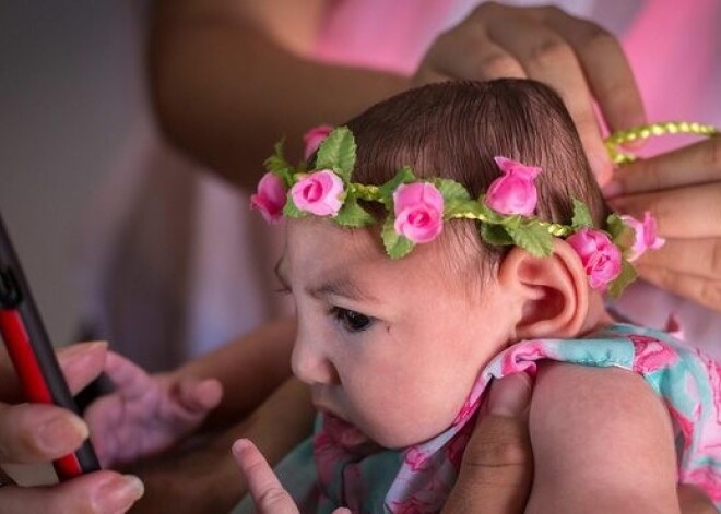 Epidemiologi: Zikas vīrusa izraisītu mikrocefālijas gadījumu parādīšanās Latvijā ir maz ticama