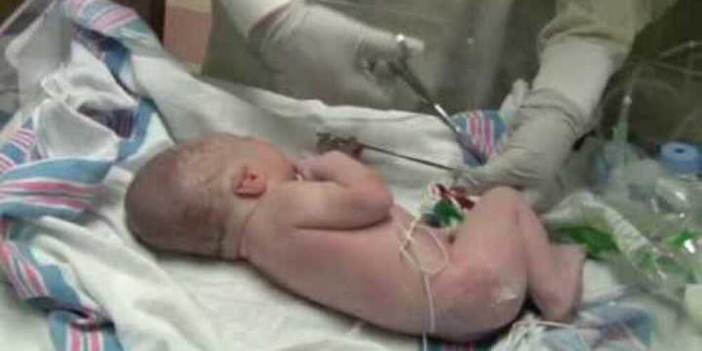 Младенцу исполнилось только 3 минуты, а он уже взялся помогать врачам