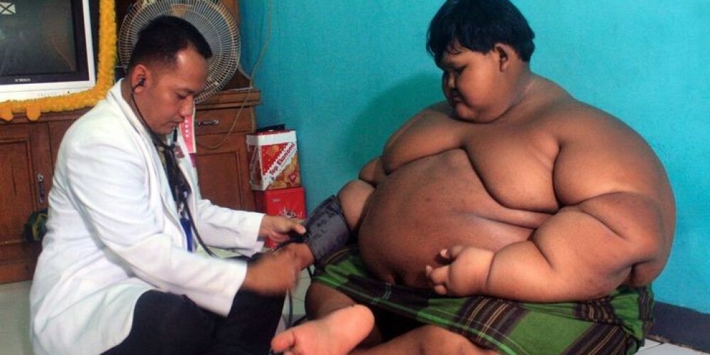 ШОК! Арья Пермана - самый толстый ребенок в мире