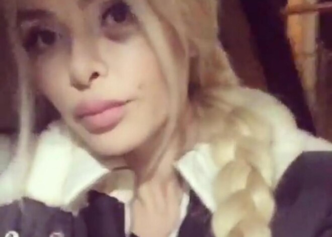 Избитая мужем Алена Кравец вновь показала синяки от побоев