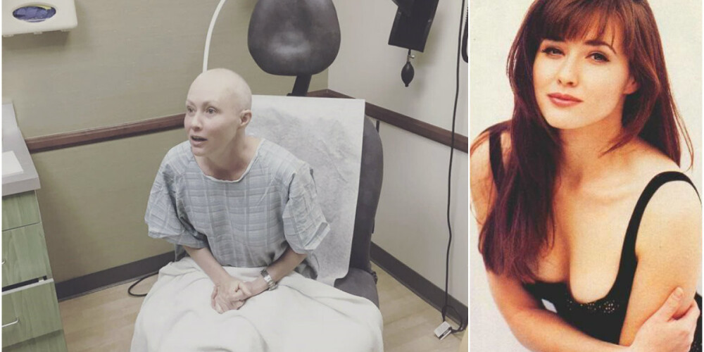 Šenona Dohertija turpina cīņu ar ļaundabīgo audzēju. Attēlā pa labi - tādu mēs viņu atceramies kā Brendu no slavenā seriāla "Beverlihilza".