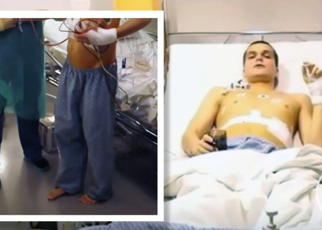 Tas ir jāredz! Īpaši asprātīgā video Austris sper savus pirmos soļus pēc operācijas. VIDEO