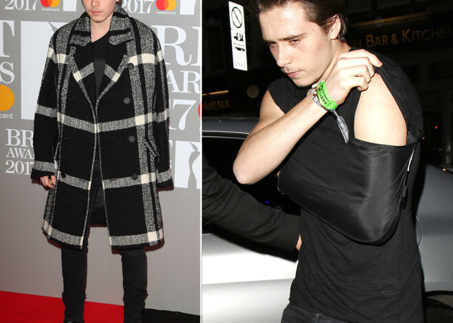 Бруклин Бэкхем пришел вышел на красную дорожку с травмированной рукой