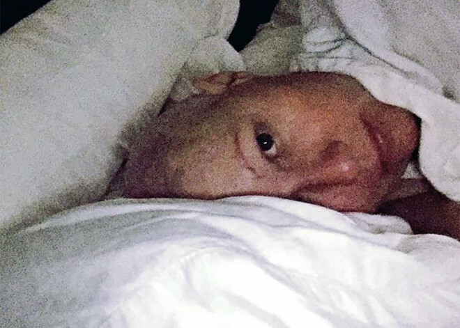 Šenona Dohertija paziņo, ka beigusi ārstēšanās kursu. Vai vēzis būs uzveikts?