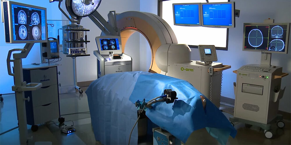 Stradiņa slimnīcā sāk operēt ar jaunu 600 000 eiro vērtu neironavigācijas iekārtu