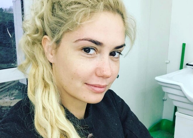 Агата Муцениеце установила виниры