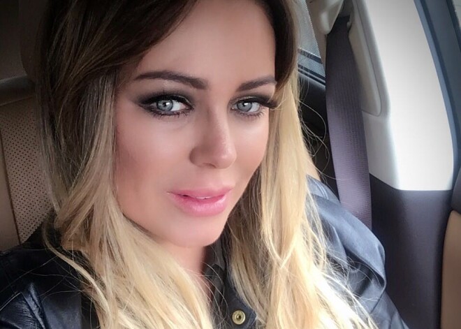 Юлия Началова шокировала опухшими руками