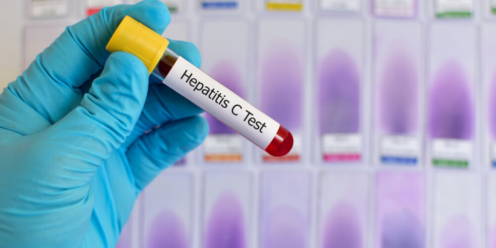 C hepatīts – infekcija, kas turpina izplatīties