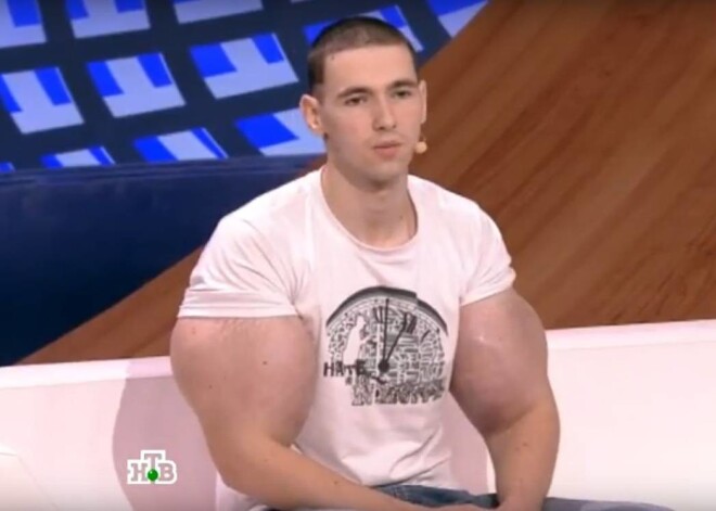 «Потерянные» человеком-синтолом «руки-базуки» вернулись назад