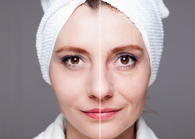 Kad sejas ovāls zaudē stingrumu... Dermatoloģes skaidrojums, kas ir sejas liftings