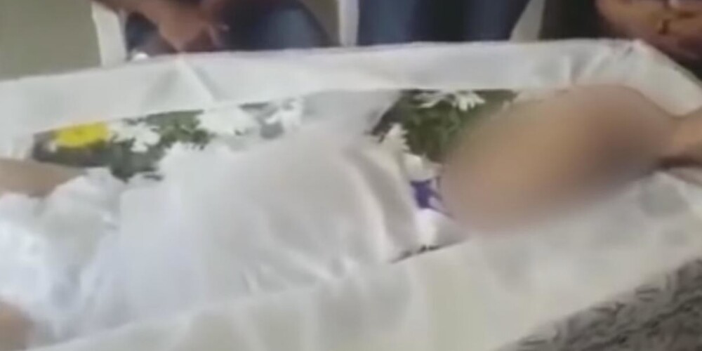 Родители остановили похороны, когда их дочь в гробу пошевелила пальцем