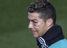 Krištianu Ronaldu zilā acs pēc dziļās rētas spārna kaulā.