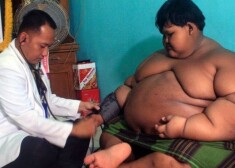 Самый толстый в мире мальчик похудел на 76 килограммов и смог наконец встать с кровати
