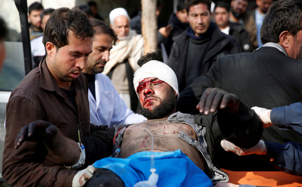 Īpaši traģisks pašnāvnieka sarīkots sprādziens Kabulā. Miruši desmitiem cilvēku; vairāk nekā 150 ievainoto