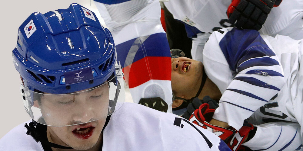 Korejas hokejists spēlē pret Kanādu paliek bez trim zobiem, bet priecājas, ka tas notika tieši šādi