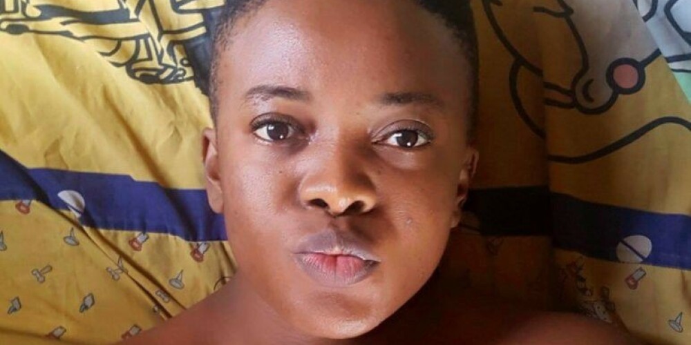 Нигерийская секс-блогерша нашла оригинальный способ борьбы с прыщами