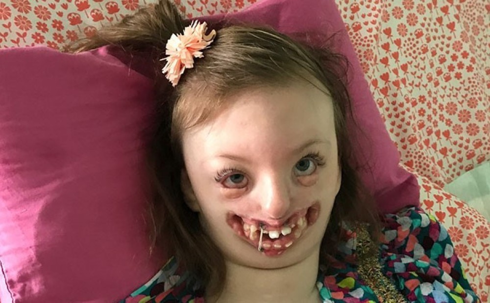 Фото этой девочки использовали для призыва делать аборты, но мать призвала Twitter к ответу