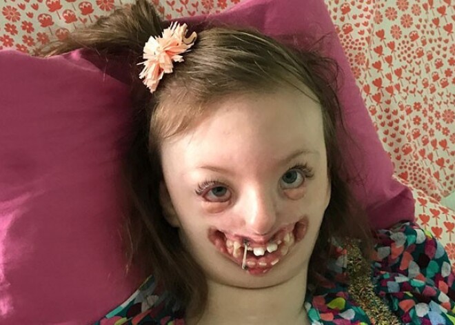 «Они использовали фотографию моей дочери как рекламу абортов»: мать больной девочки отомстила обидчикам