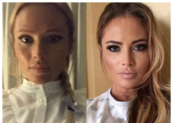 Дана Борисова показала себя до и после лечения от наркозависимости