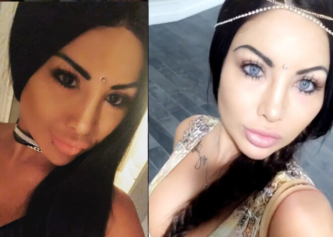 Кареглазая модель стала голубоглазой и потеряла зрение