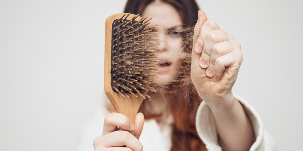 Pastiprināta matu izkrišana var signalizēt par nopietnām veselības problēmām