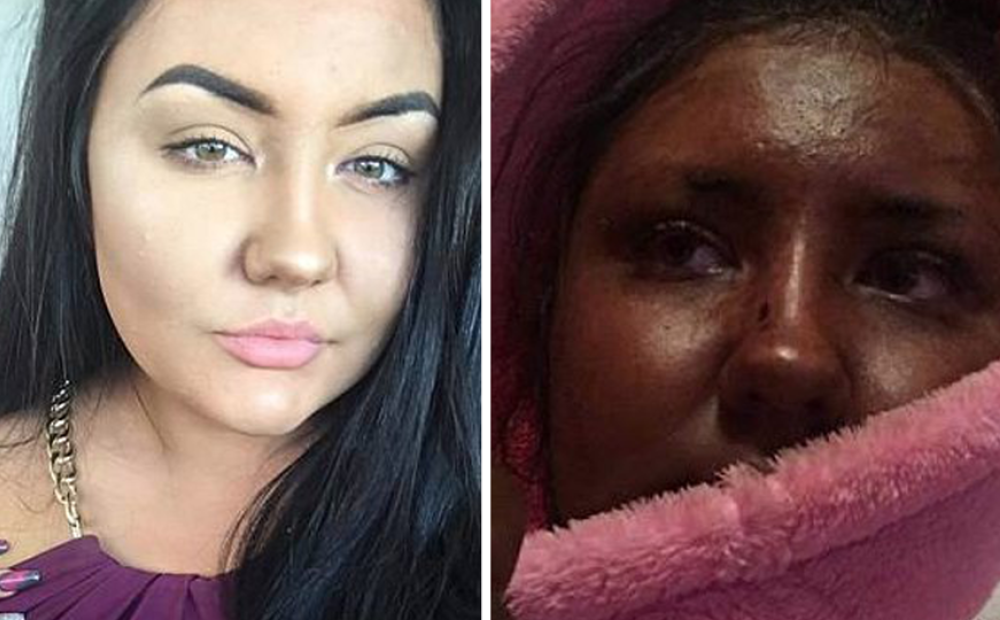 Испортить внешний вид. Загорела на половину лицо. Позеленела от автозагара. Девушка позеленела от автозагара. Кожа позеленела после автозагара.