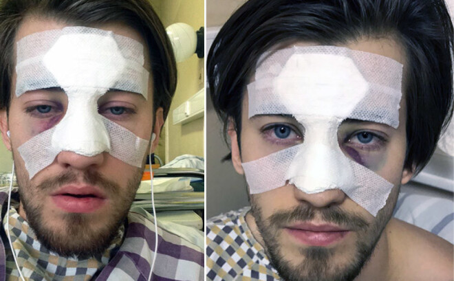 Cietušais Aksels Aizkalns jau no paša sākuma bija neizpratnē par britu mediju versiju, jo patiesība, ko viņš nākamajā dienā atklāja portālam Jauns.lv bija pavisam tālu no viņu versijas.