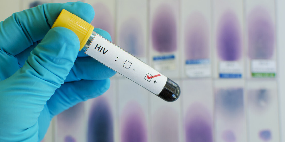 Медики создали вакцину против ВИЧ
