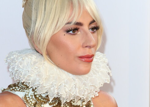 Lady Gaga vēl nebija slavena, kad viņai ieteica operēt degunu skaistuma vārdā, taču viņa atteicās to darīt. Vai tas traucējis dziedātājai iemantot slavu?