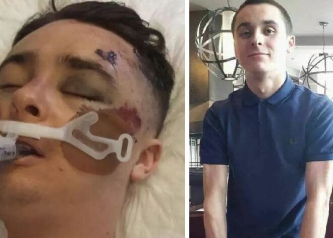 Отец в назидание выложил душераздирающее фото умирающего сына