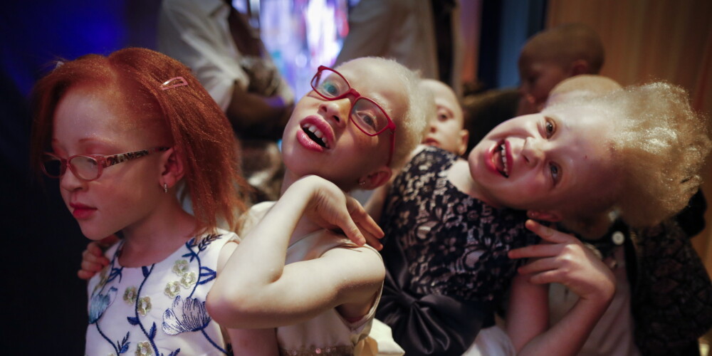 FOTO: cīnoties pret vardarbību, cilvēki ar albīnismu Kenijā piedalās skaistumkonkursā