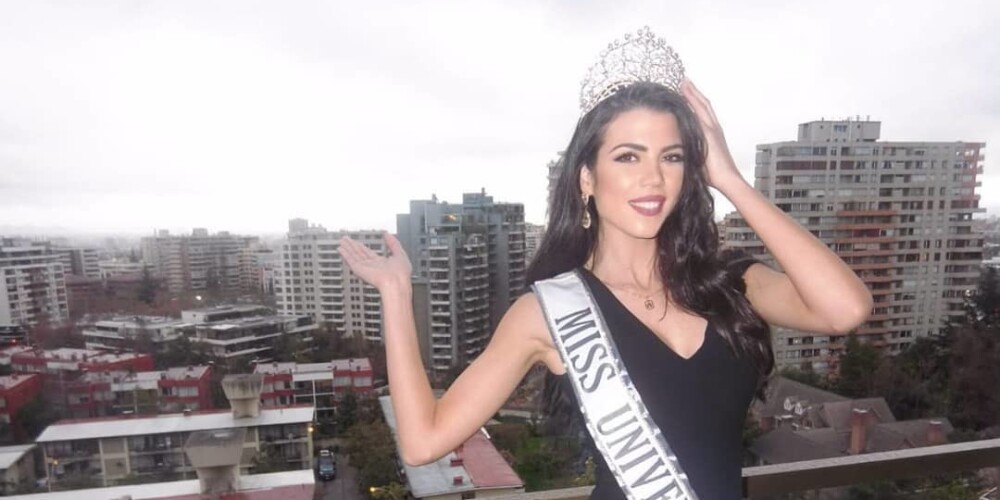 Участница конкурса "Мисс Вселенная - 2018" показала изуродованное кислотой лицо