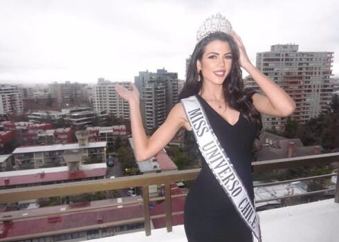 Участница конкурса "Мисс Вселенная - 2018" показала изуродованное кислотой лицо