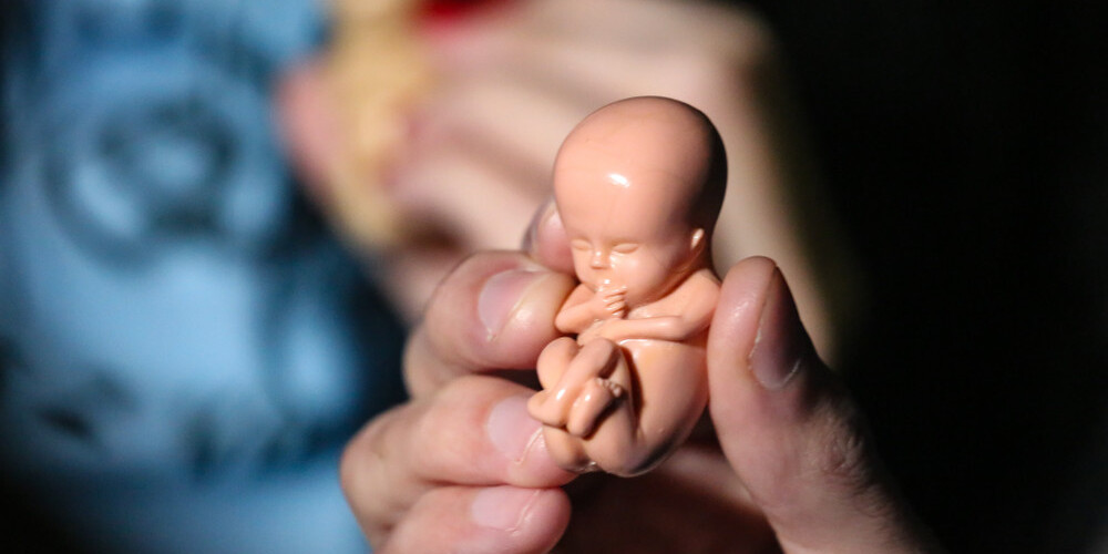 Пациентка не хотела платить за аборт: врач из Даугавпилса про скандал с потерей ребенка