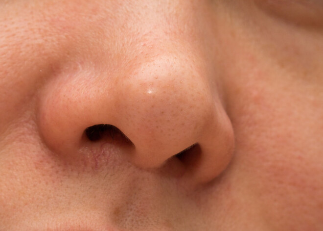 Нос человека выдает его скрытые болезни