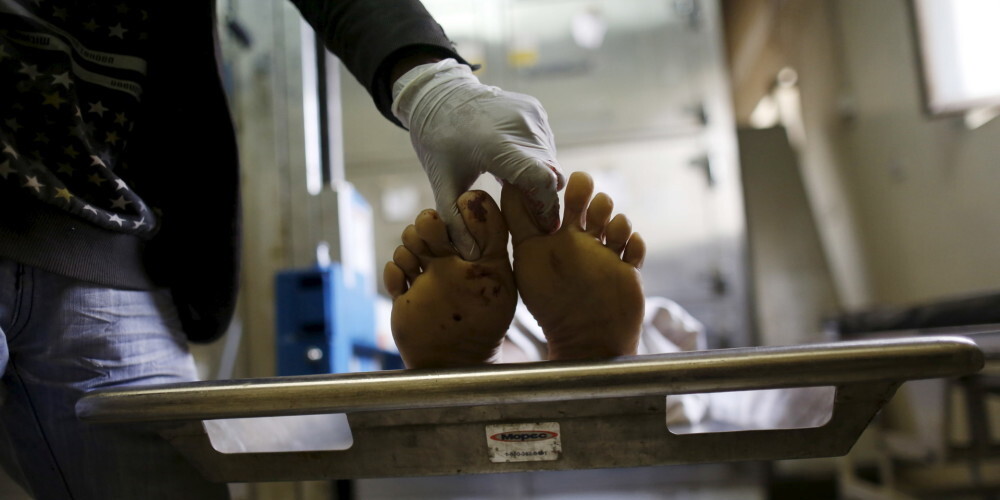 В России пациентка ожила в морге, а потом еще раз умерла