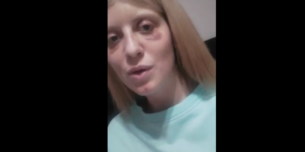 Латвийская певица, которую в Египте держал в неволе и избивал бойфренд, обратилась с эмоциональным посланием