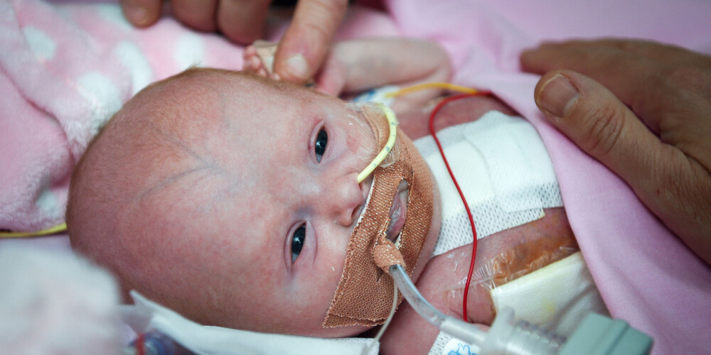 Meitenīte, kura piedzima ar sirdi ārpus ķermeņa, izrakstīta no slimnīcas