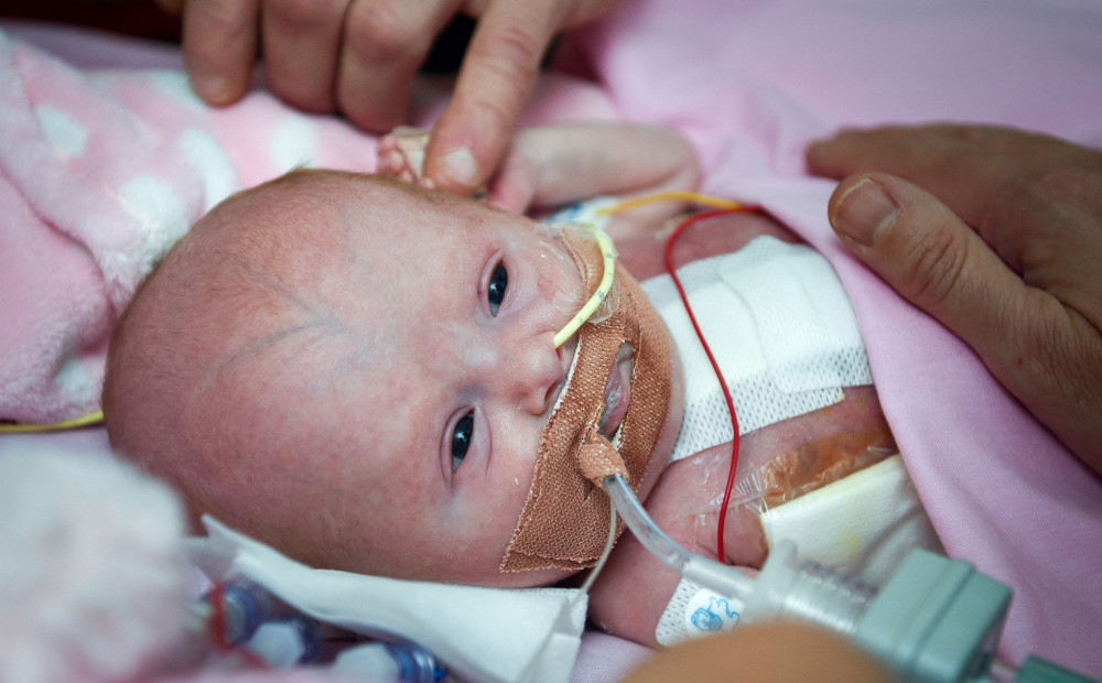 Meitenīte, kura piedzima ar sirdi ārpus ķermeņa, izrakstīta no slimnīcas