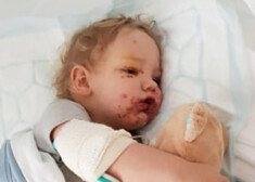 Mazais Kalo ar herpes vīrusu inficējies no kāda pieaugušā.