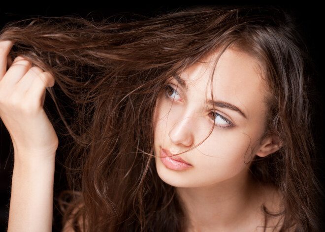15 tipiskākie iemesli, kāpēc izkrīt mati
