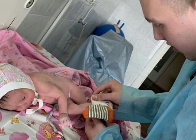 Уникальный случай: женщина-«бабочка» родила здорового ребенка